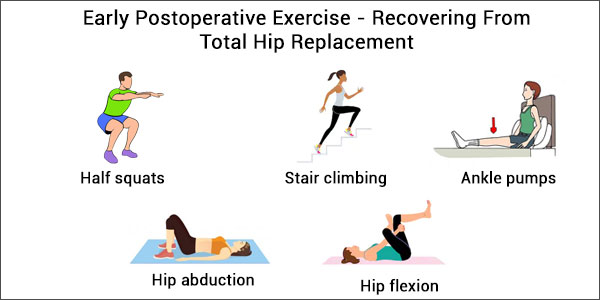 Total Hip Replacement Surgery – Early Postoperative Exercise To